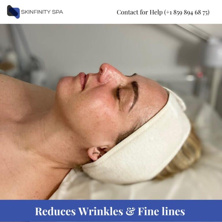 Chemical Peel Reduces wrinkles & Fine lines