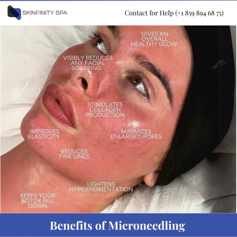 Benefits of Microneedling