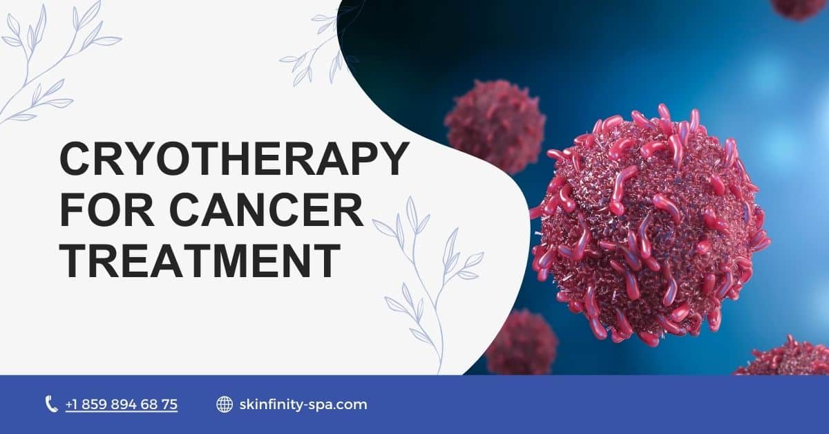 Cryotherapy for Cancer: Benefits, Risks, and Treatment Insights