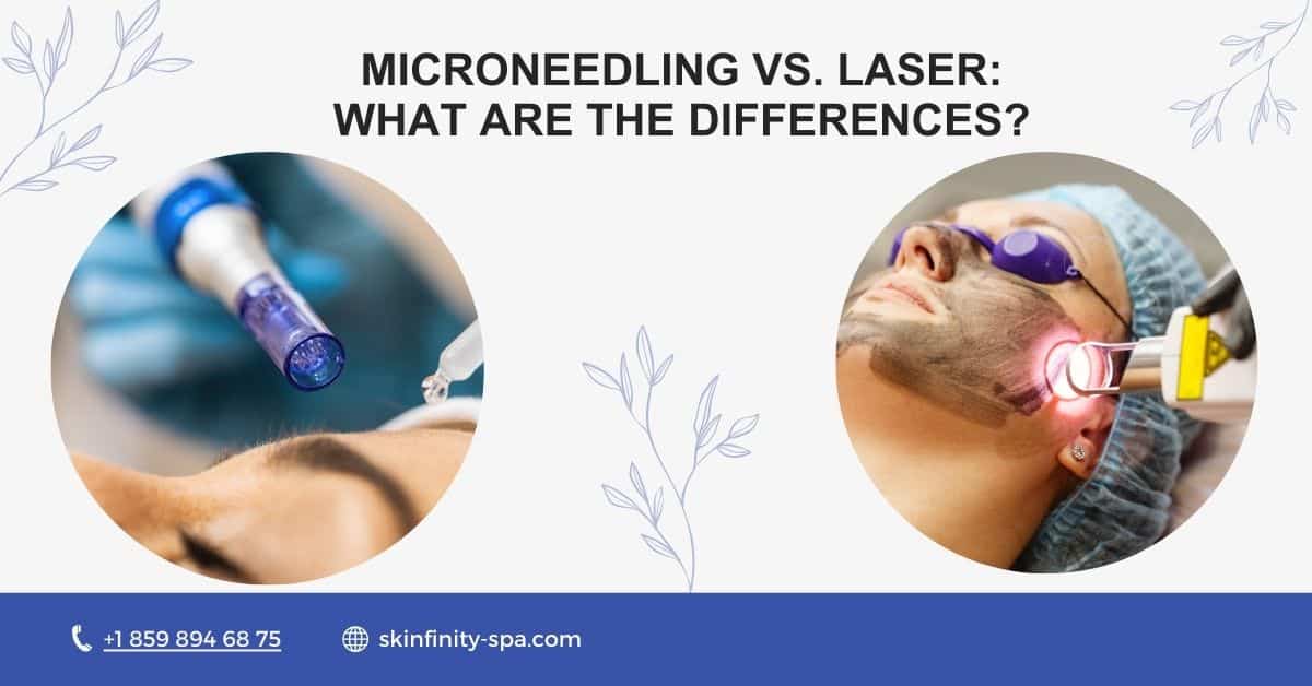 Microneedling vs. Laser What Are the Differences