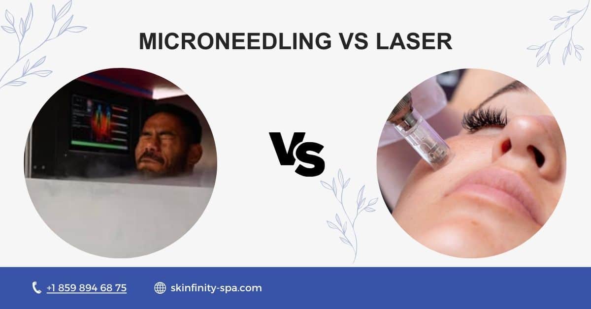 Microneedling vs. Laser Which Skin Treatment is Best