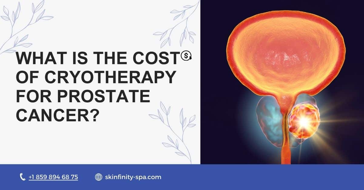 What is the Cost of Cryotherapy for Prostate Cancer